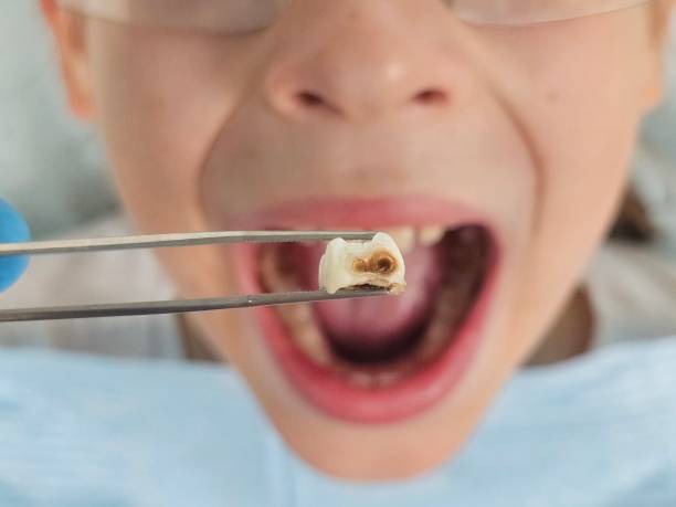 Best Emergency Orthodontic Repairs in Woodsville, NH